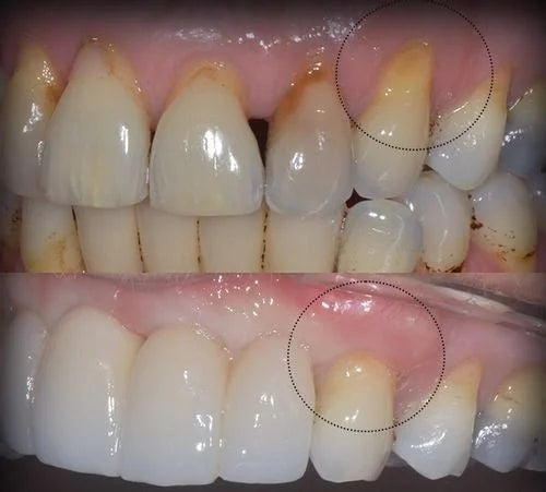 Liora Life™ Gum Fix Spray